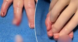 Babyâs finger allegedly severed at day care center